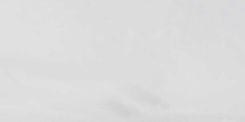 从脱发治疗到植发手术:一份全面的现代头发修复指南